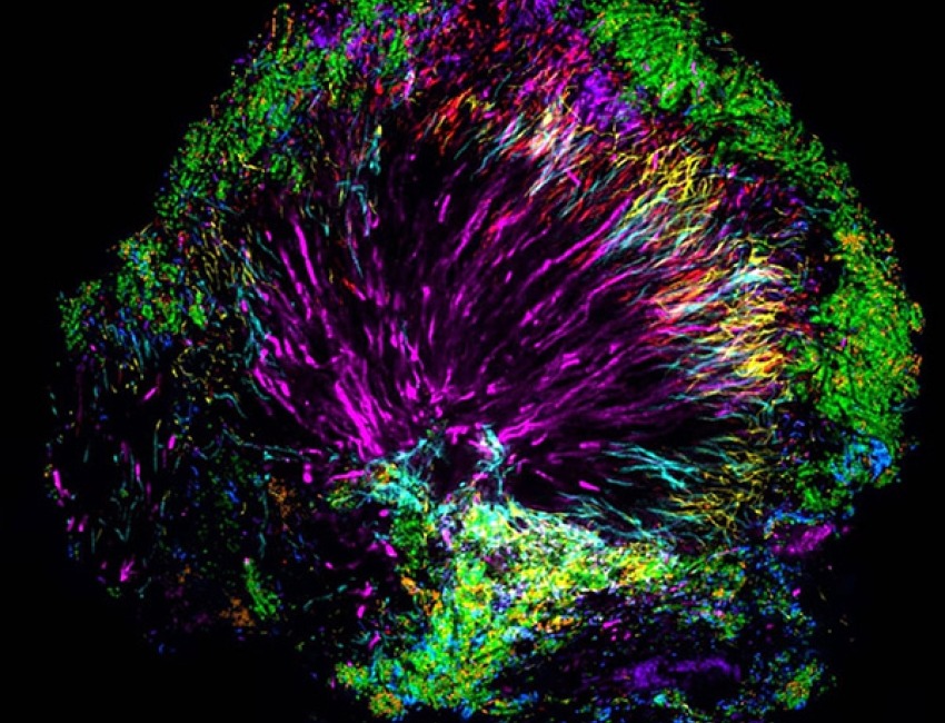 Far from a random grouping of cells, the microbiome community in human dental plaque is well-organized.